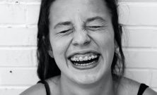 Tannregulering i Oslo: Smil med selvtillit